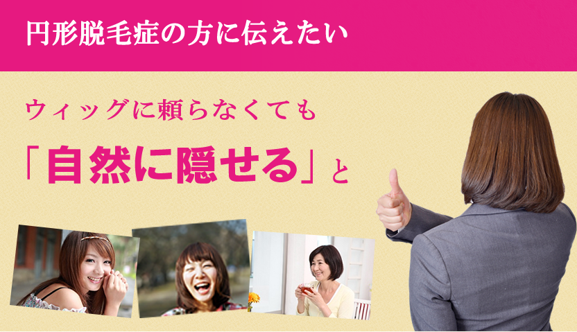 円形脱毛症の方へ、ウィッグを使わずに自然に隠せます