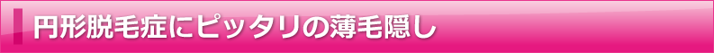 円形脱毛症にピッタリの薄毛隠し